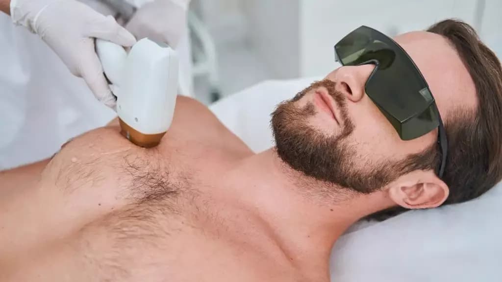 Depilacja laserowa dla mężczyzn